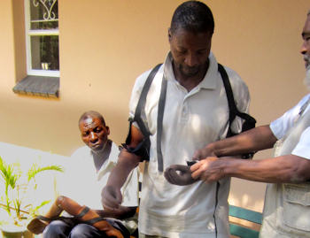 prosthetic_arms_after